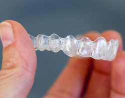 invisible braces 01 250x195 - Каппы Invisalign