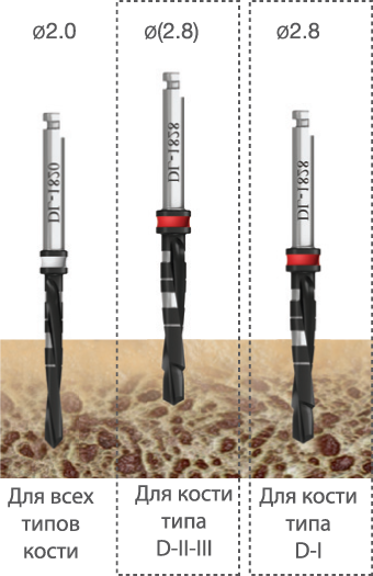 implantat touareg np 3.0 boring - Имплантат ADIN - TOUAREG NP
