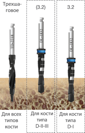 implantat touareg s 3.5 boring - Имплантат ADIN - TOUAREG S