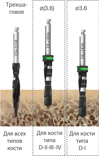implantat touareg wp 4.3 boring - Имплантат ADIN - TOUAREG WP